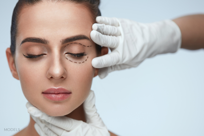 Difference Between Upper And Lower Blepharoplasty