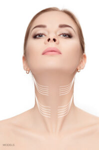 Where Are The Incisions Of A Neck Lift Placed?