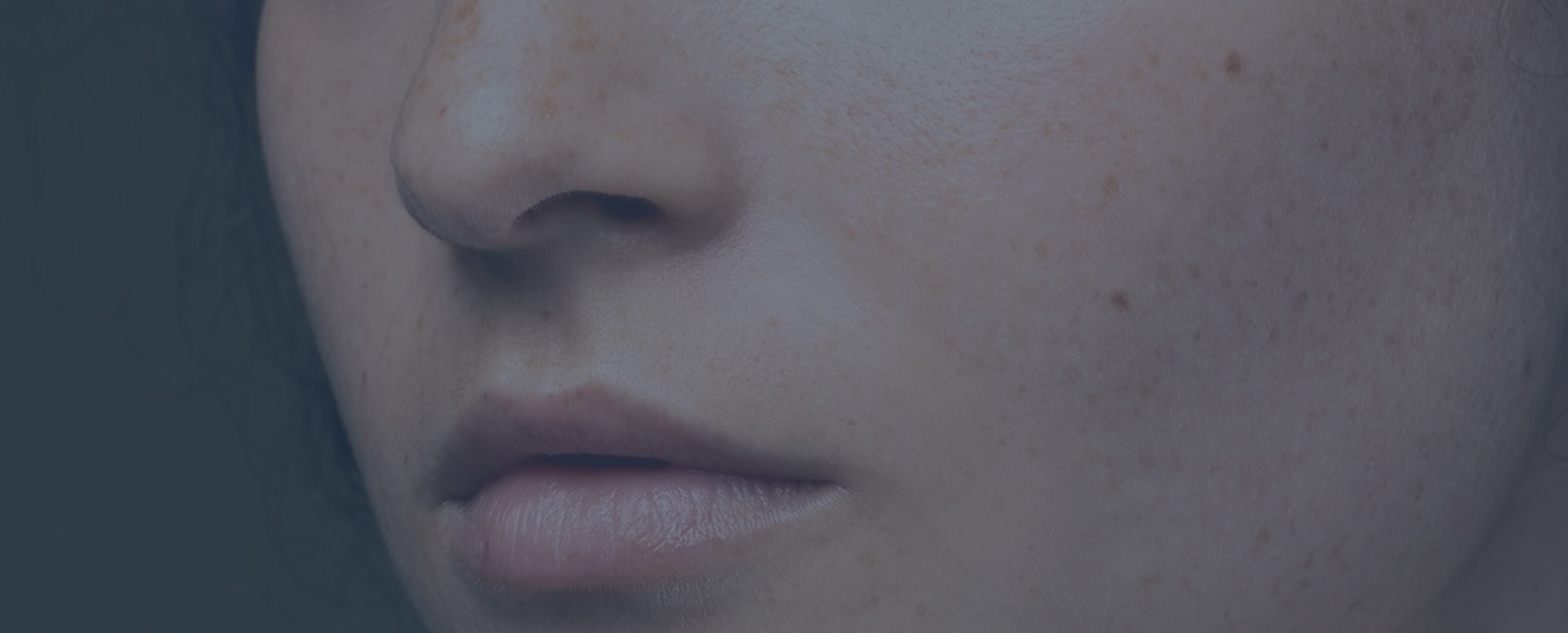 PIGMENTATION AND BROWN SPOTS_